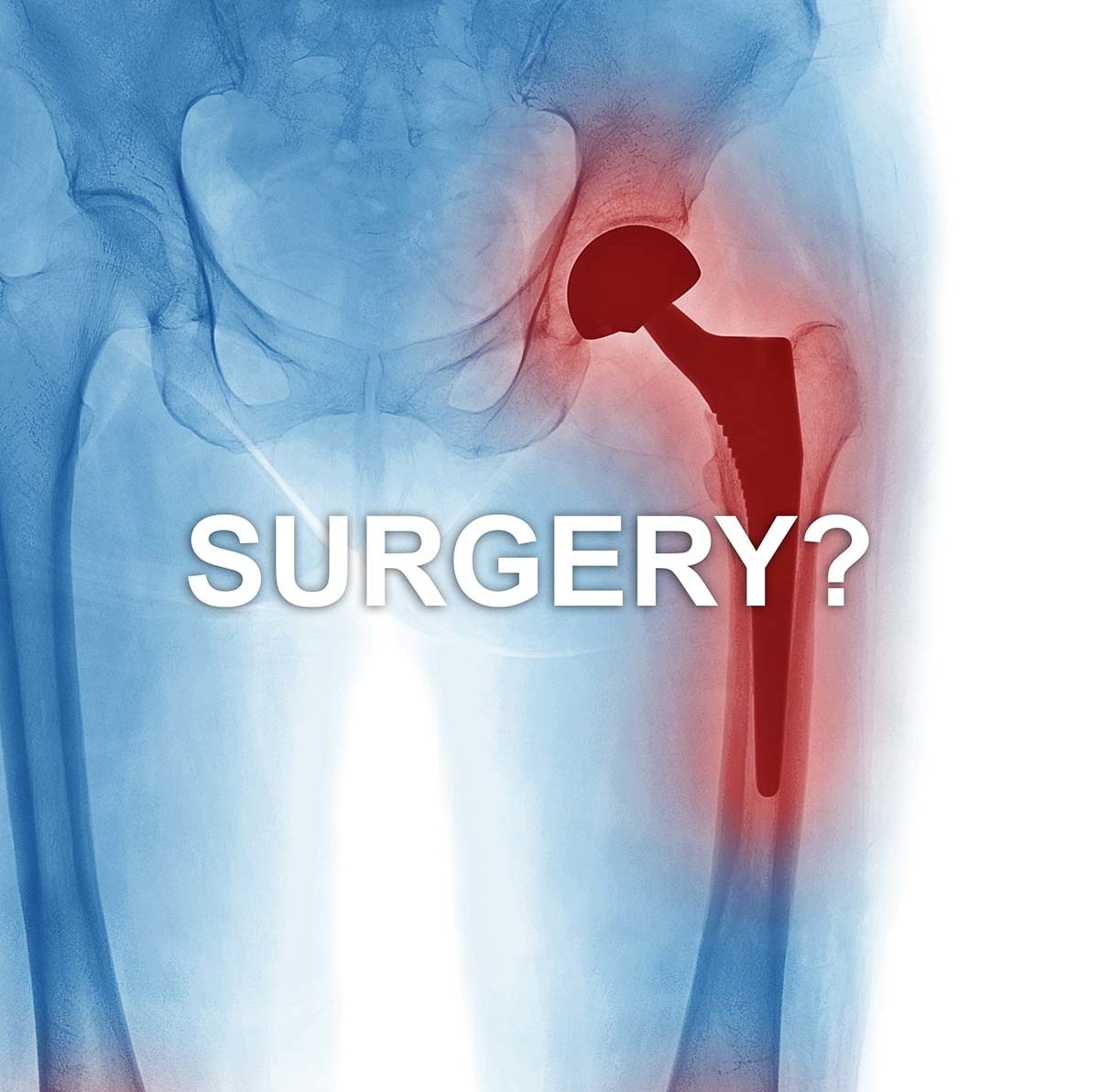 Hip Pain Orthobiogen