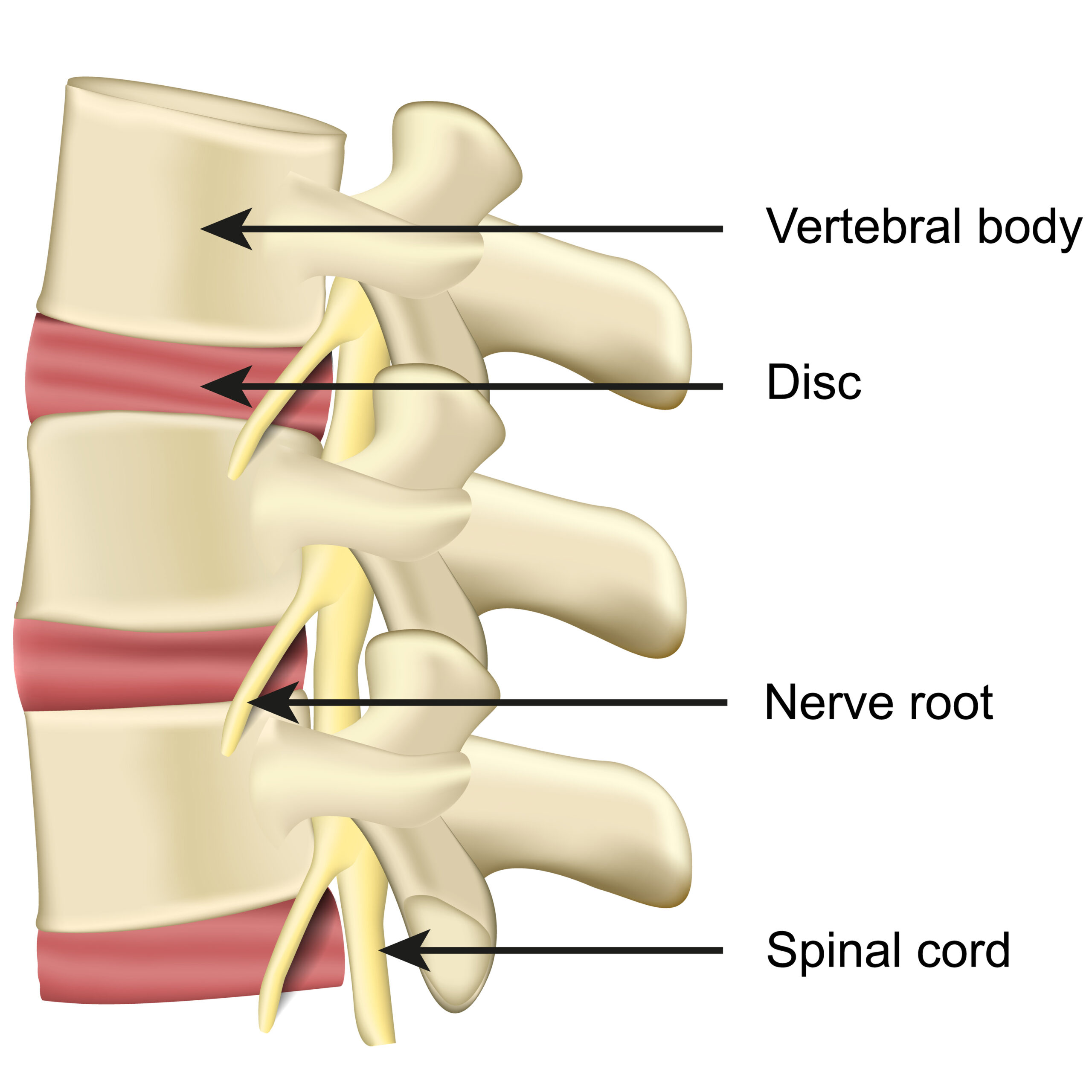 Neck Pain - OrthoInfo - AAOS